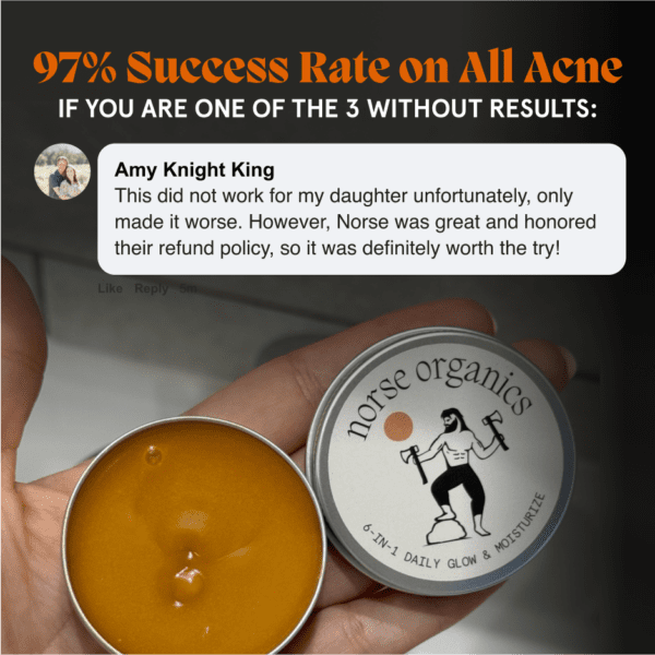 Kill Acne & Redness Ritual - Image 9